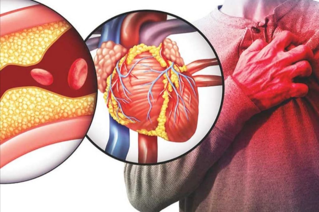 ස්වභාවිකවම කොලෙස්ටරෝල් මට්ටම අඩු කරගන්න ඕනිද ? මෙන්න ඒකට සුපිරිම විදිහ…