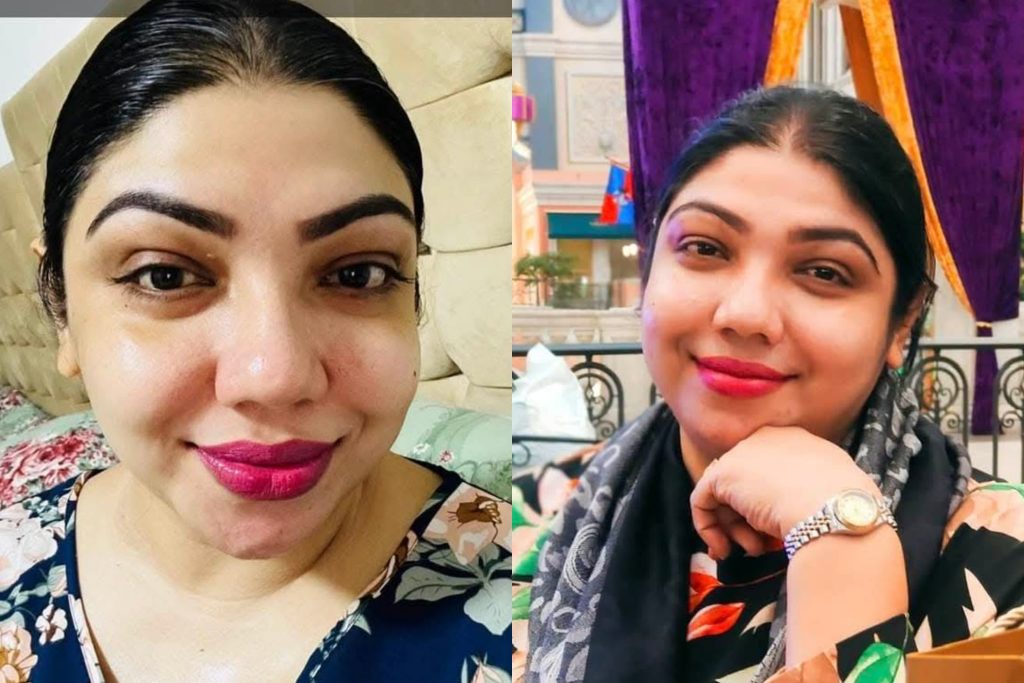 ලස්සන මුහුණක්… දවසක වැහැරිලා යාවී… නමුත් හොඳ හදවතක් හැමදාම තියේවී….” රටක් ආදරේ කරන ඇය ෆේස්බුක් ඇවිත් කියන මේ කතාව මොකද්ද ?