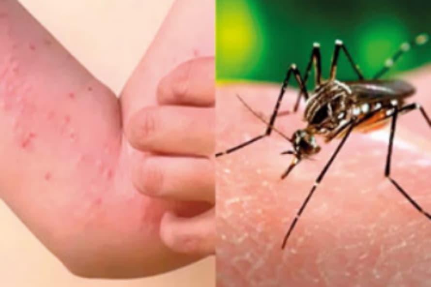 දෙමව්පියන් මේ ගැන දැනුවත් වෙන්න. මෙහෙම දිනවලට දරුවන් පාසල් යවන්න එපා.