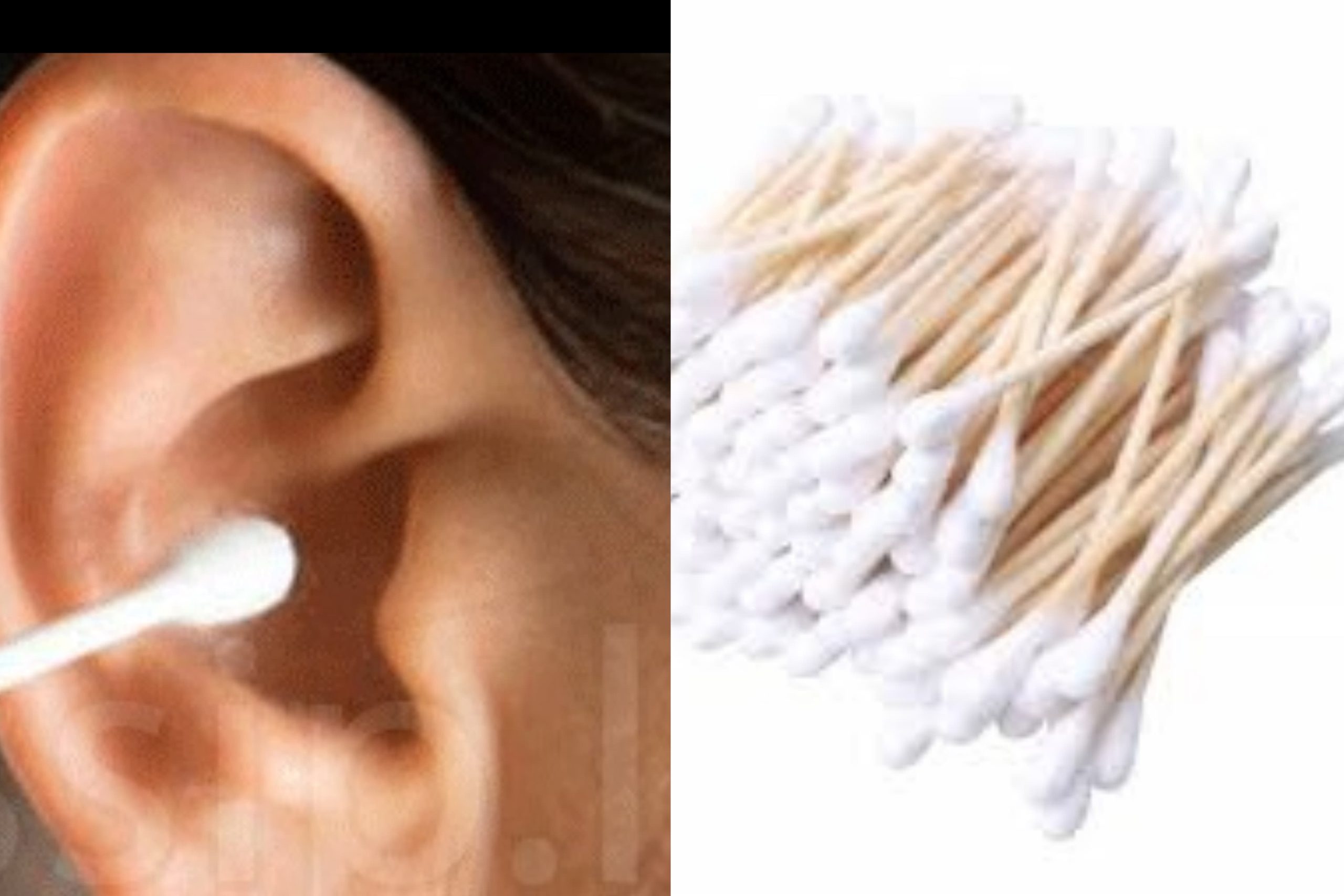 රෝගකාරක බැක්ටීරියාව වර්ධනය වුණේ කොහොමද කියන එක අවසානයේ වෛද්යවරුන්ටත් ගැටලුවක් වුණා.. ඔබටත් මේ පුරුද්ද තියනවා නම් වහාම ඒක නවත්වන්න..