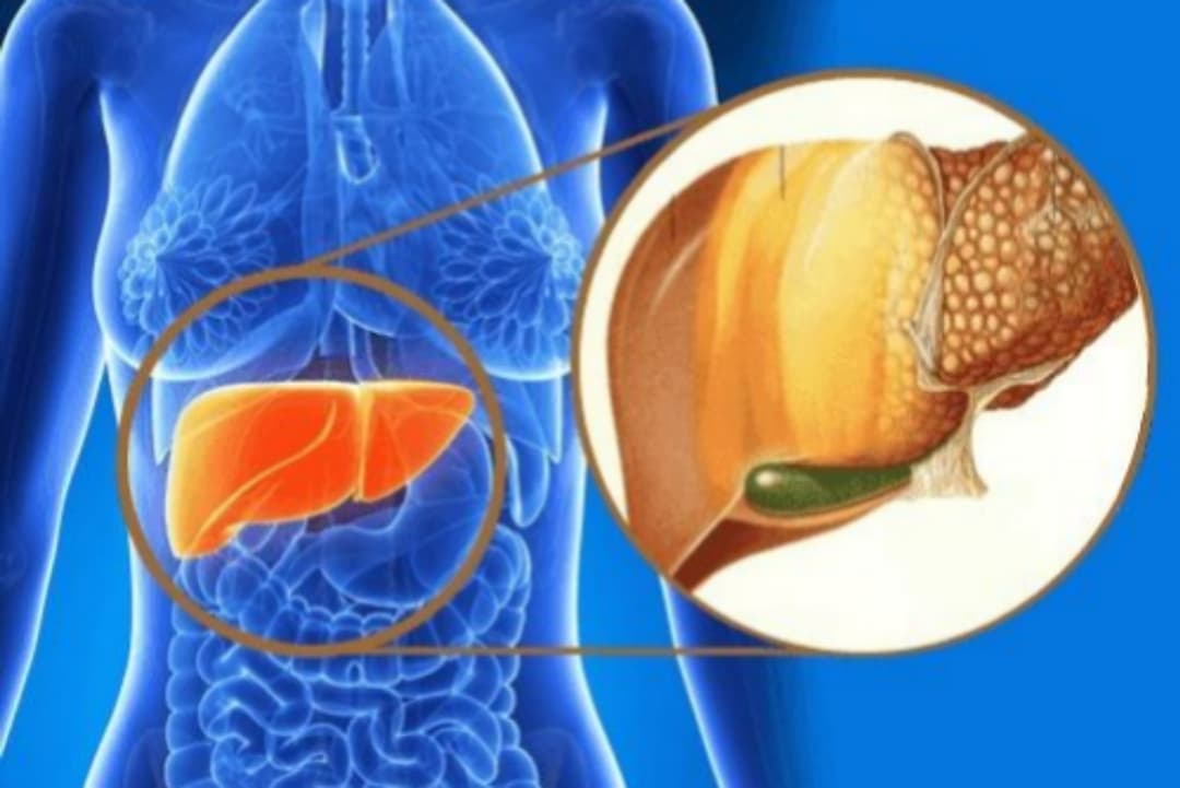 මේ කෑම කෑවොත් අක්මාවේ තෙල් නිකන්ම දියවෙලා යනවා කියන්නේ ඔබත් මීට පෙර දැන සිටියාද ?