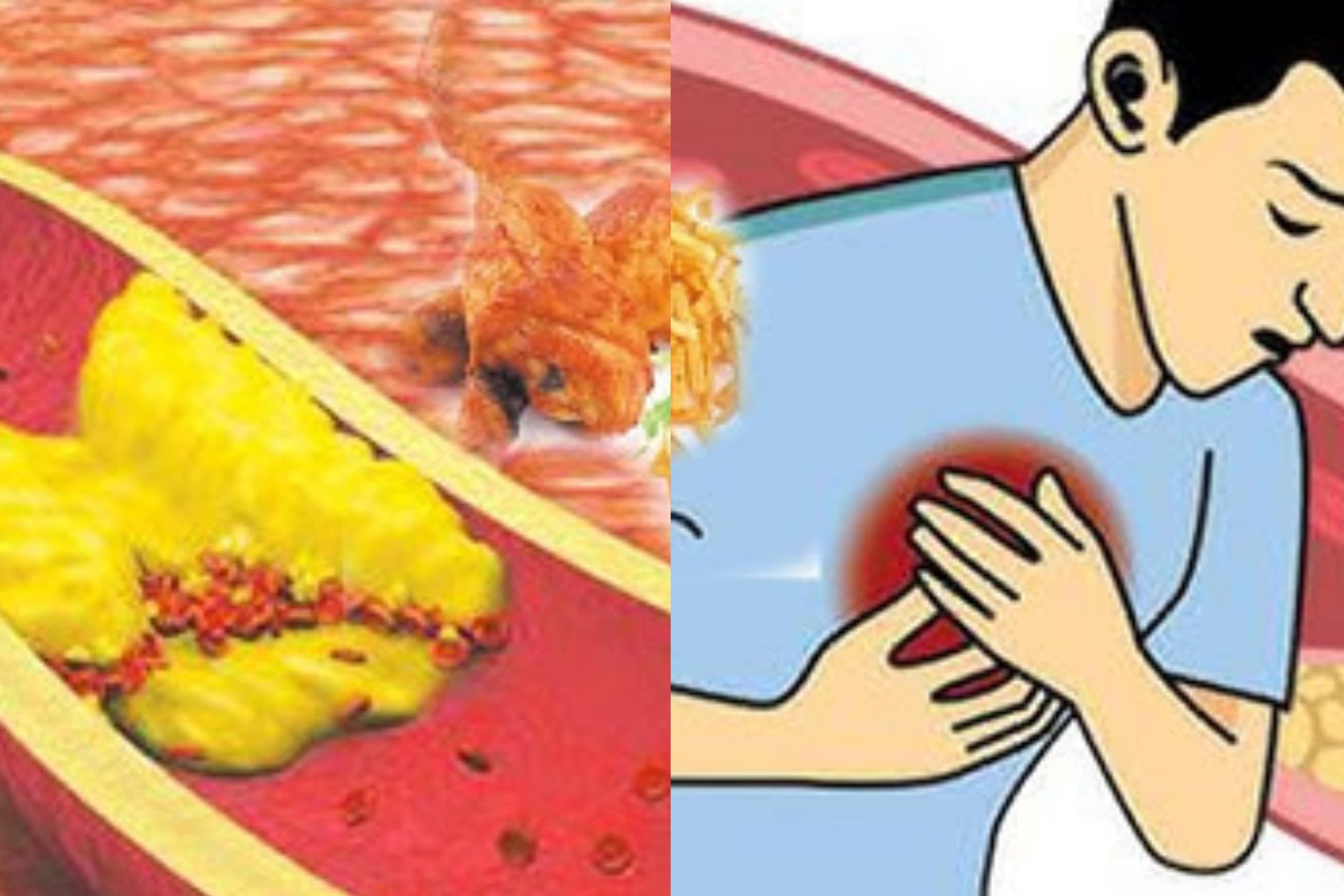 ඔයාටත් කොලෙස්ටරෝල් තියෙයි නම් මේ ආහාර අකැපයි. හරියට දැනගන්න