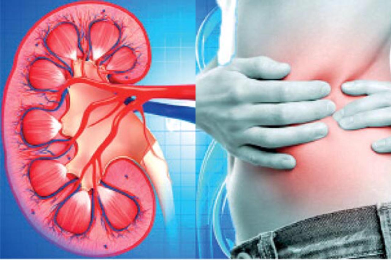 ඔබට වකුගඩු රෝගයක් තිබේදැයි මුලික අවස්ථාවේම දැන ගන්නේ මෙහෙමයි..