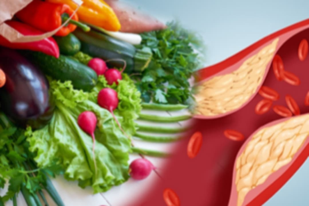 ස්වභාවිකවම කොලෙස්ටරෝල් පාලනය කරගන්නේ මෙහෙමයි. ගෙදර ඉදන් කරලා බලන්න