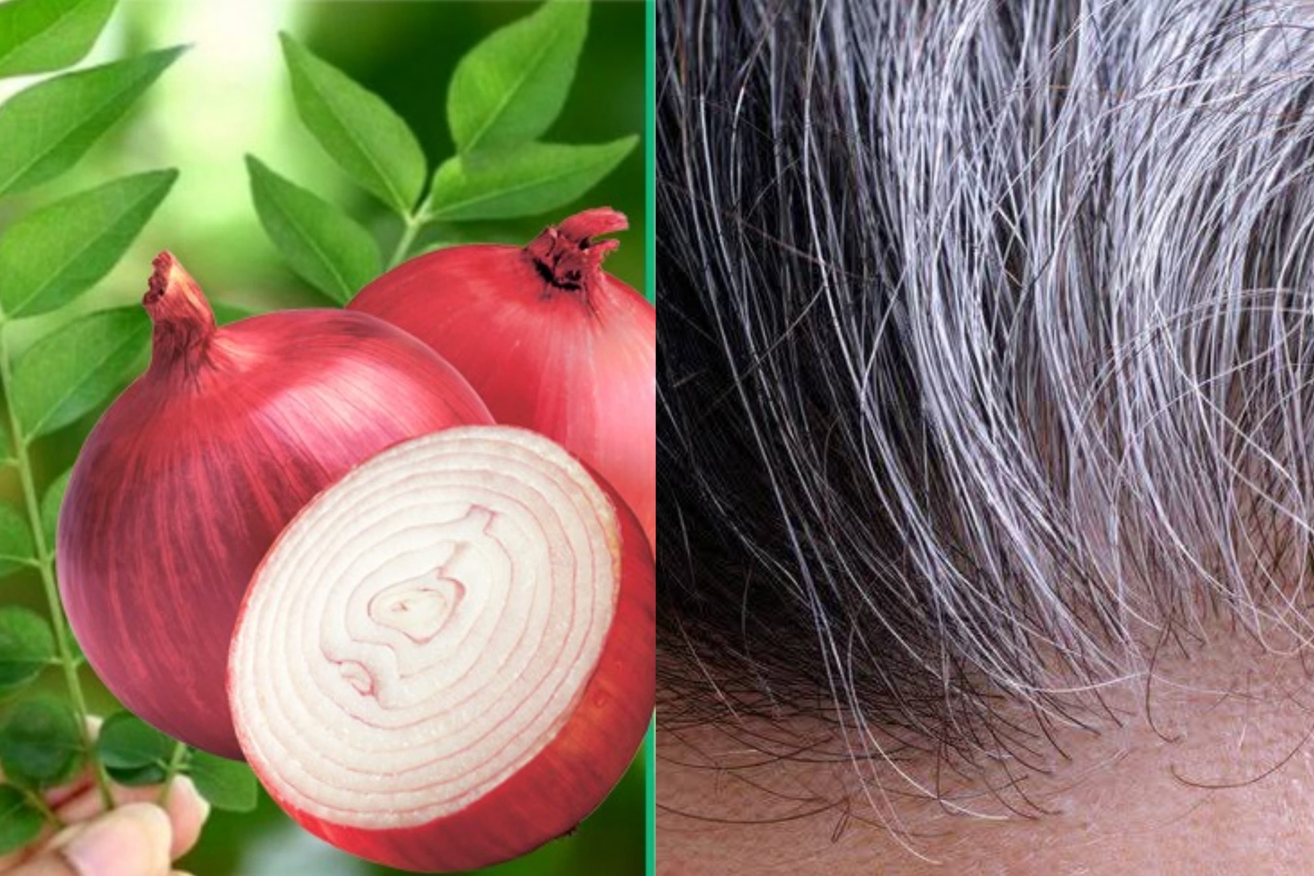 විනාඩි 5න් සුදු කෙස් නැත්තටම නැති කරන විශ්මිත සත්කාරයක් මෙන්න. අකලට හිසකෙස් පැසුණු ඔබට ඉතාමත් වැදගත් වේවි