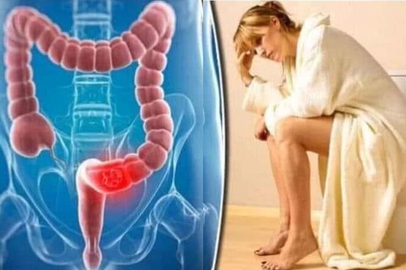 බොහෝ දෙනෙක් දුක් විඳින අරිශස් රෝගයට මෙන්න සාර්ථක විසඳුම