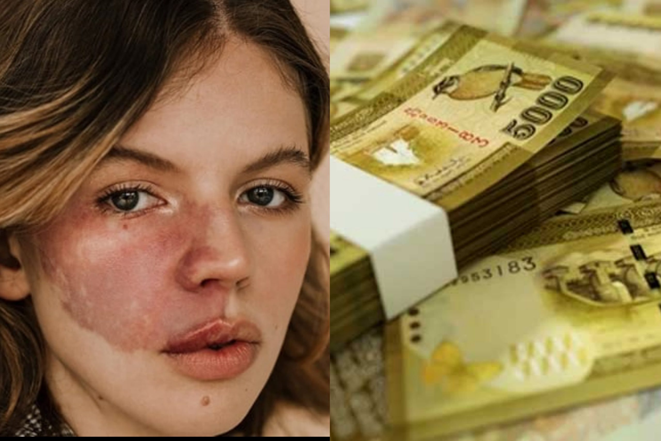 ධනවත්වීමේ රහස ඔබේ උපන් ලපයෙන් හෙලි වෙන බව දන්නවද ? උපන් ලපයෙන් කියවෙන රහස මෙන්න