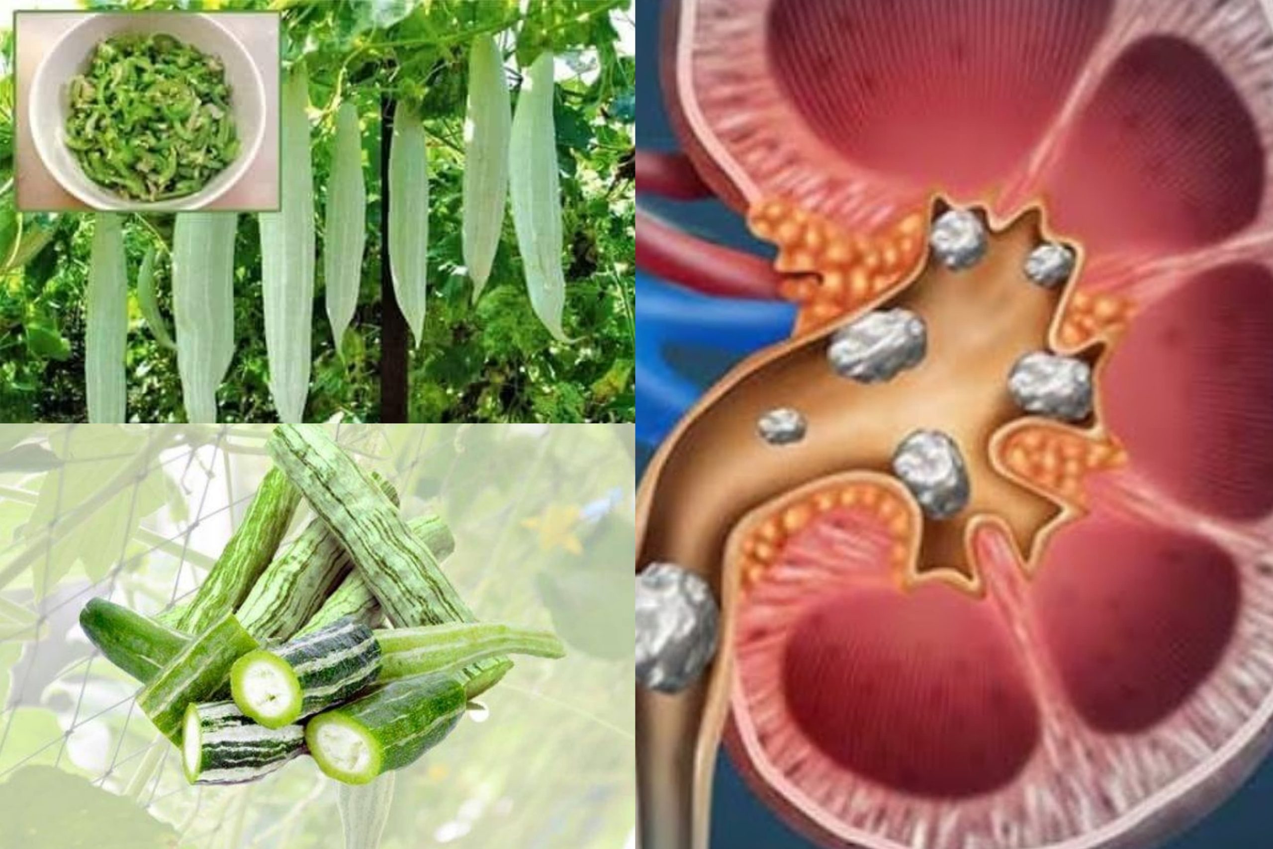 වකුගඩුවල ගල් ස්වභාවිකවම ඉවට්ග් කරන අපි නොදන්නා විශ්මිත ඔසුව පතෝල ගැන පුදුම හිතෙන කතාවක් මෙන්න