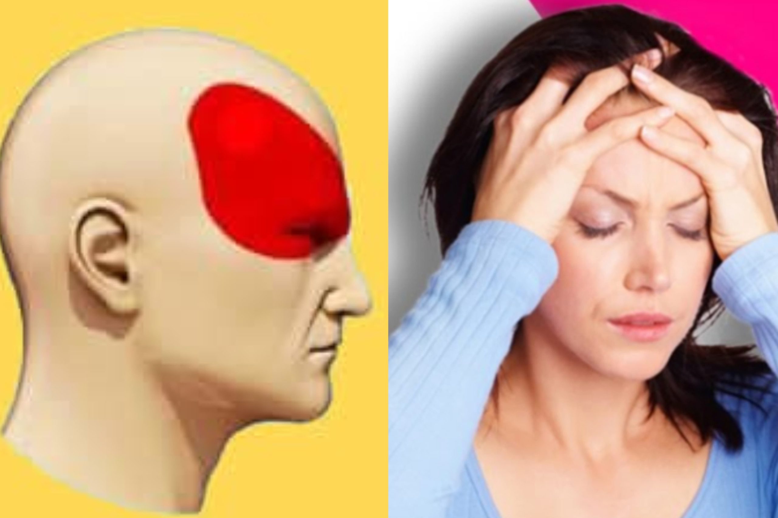 මිග්රේන් – ඉරුවාරදය නැත්තටම නැති කරගන්න මේ කෑම වර්ග ආහාරයට ගන්න