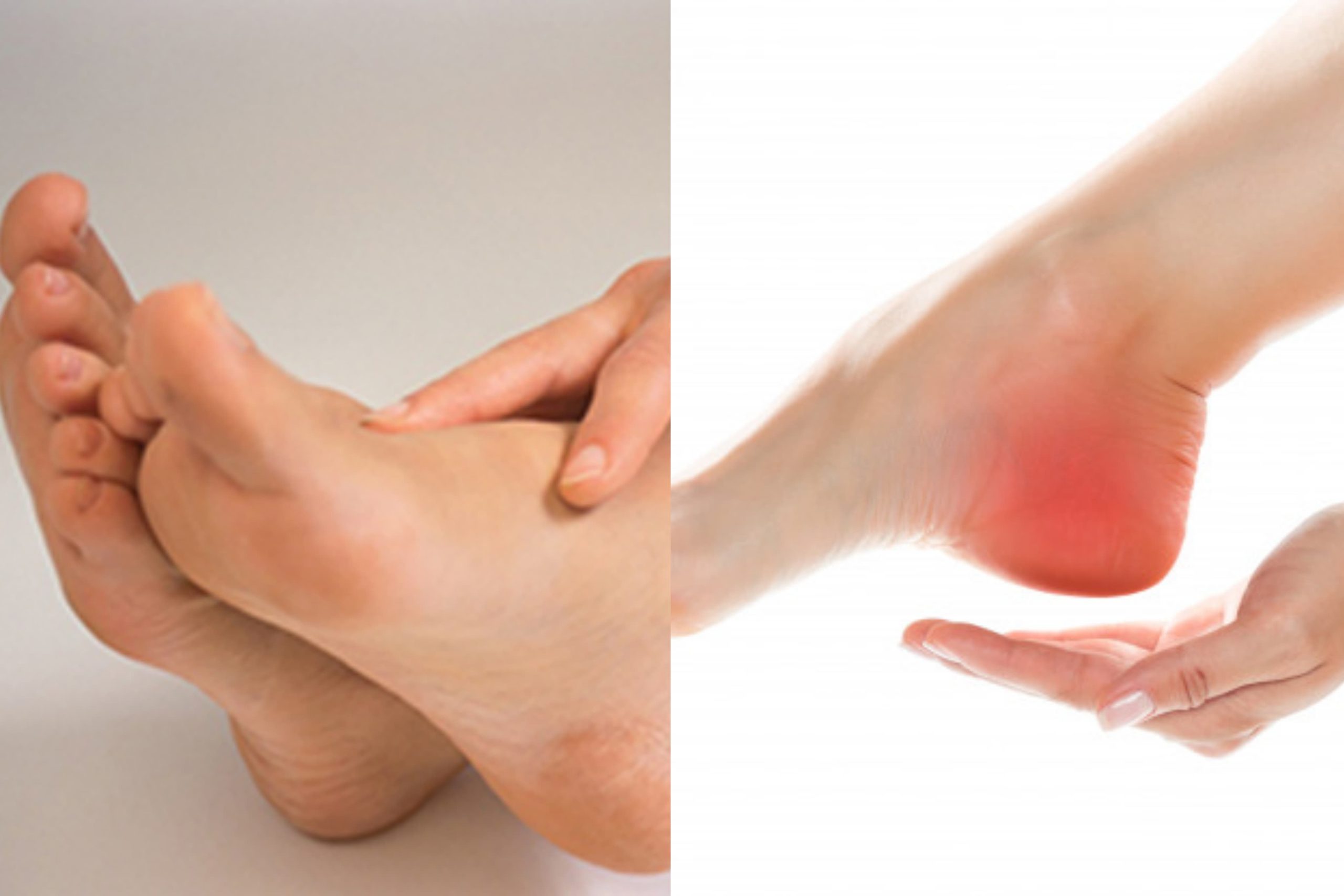 උදේට ඇතිවෙන විළුඹේ වේදනාව ඔයාටත් තියෙනවාද ? එහෙනම් ලොකු ලෙඩකට මුලක්…! මේ ලිපිය කියවන්නකෝ