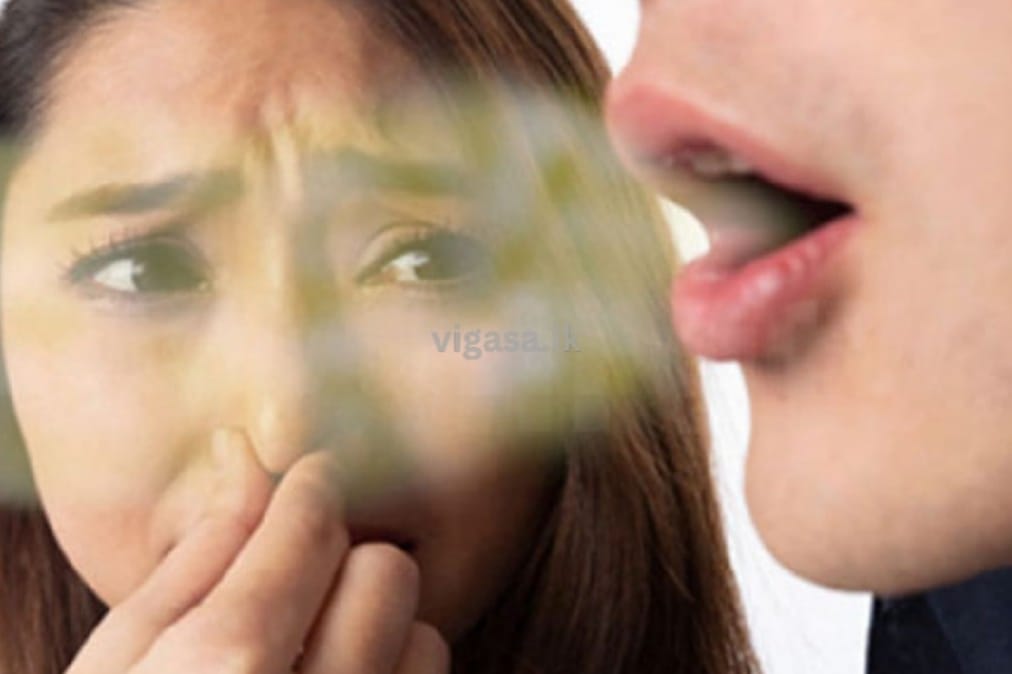 ඔයාගෙත් කට ගදයිද ? කාටවත් කියන්න බැරුව පීඩාවෙන්ද හිටියේ.. එහෙනම් මෙන්න විසඳුම..