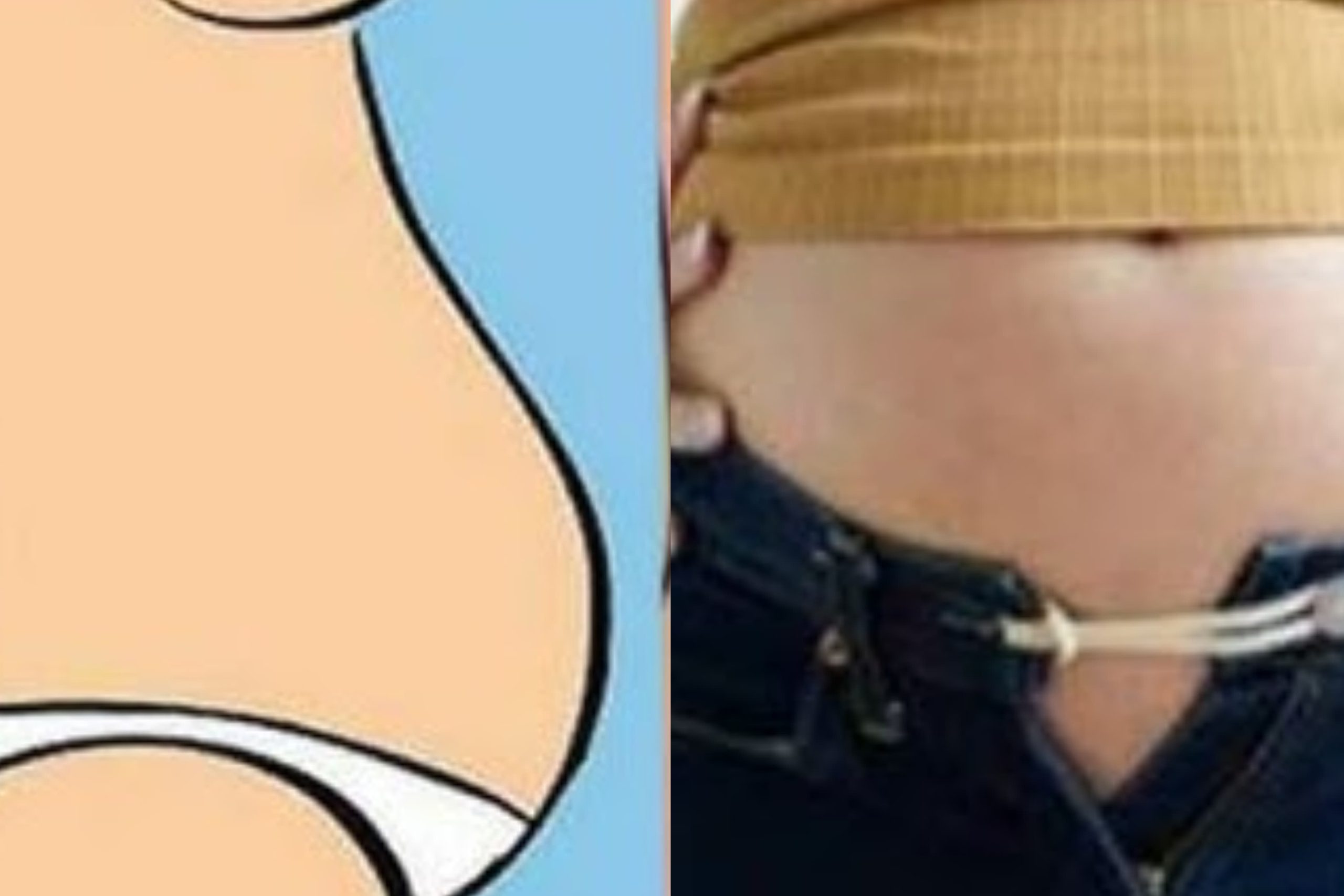 ගොඩක් දෙනෙක් මේ රෝගය නිසා පීඩා විදිනවාද ? බඩ පිපුම තියෙයි නම් සුලුවට හිතන්න එපා..!