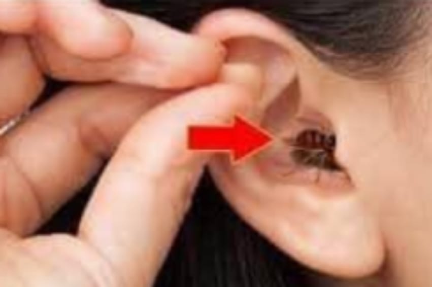 ඔයාගේ කනට සතෙක්ගියොත් කරන්න ඕනි මොනවද කියලා දන්නවද ? මෙන්න නිවැරැදිම පිලියම…