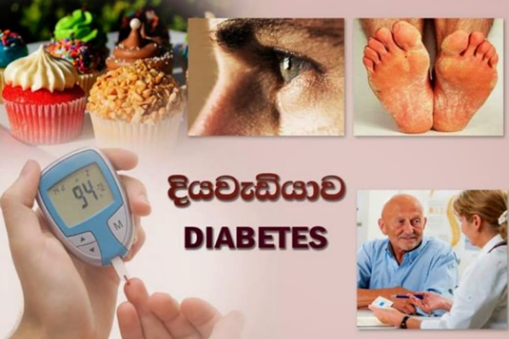 ඔයාටත් දියවැඩියාව නම් මෙන්න ඔබ සුව කරන ගෙදර වත්තෙන්ම හොයාගන්න පුලුවන් මීට පෙර අසා නැති ඔබ නොදත් විශ්මිත පානයක්..