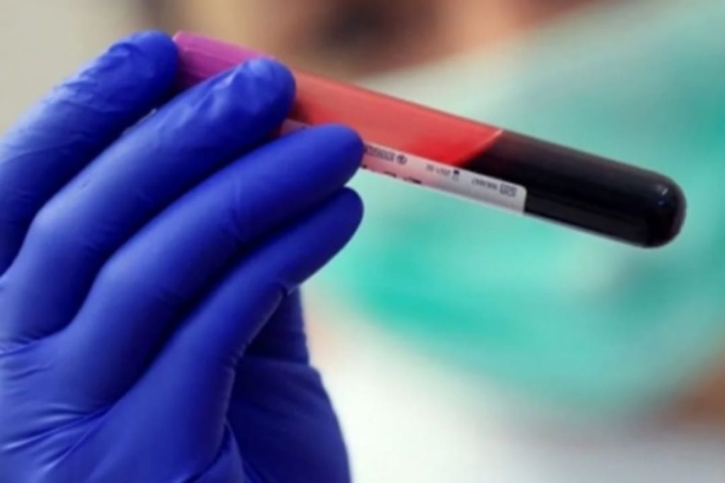 ලොව එකම පුද්ගලයා ඇයයි. ඉන්දියාවෙන් හමුවූ නව රුධිර ඛාණ්ඩයක් ගැන ලොවක් මවිත කල පුවත මෙන්න