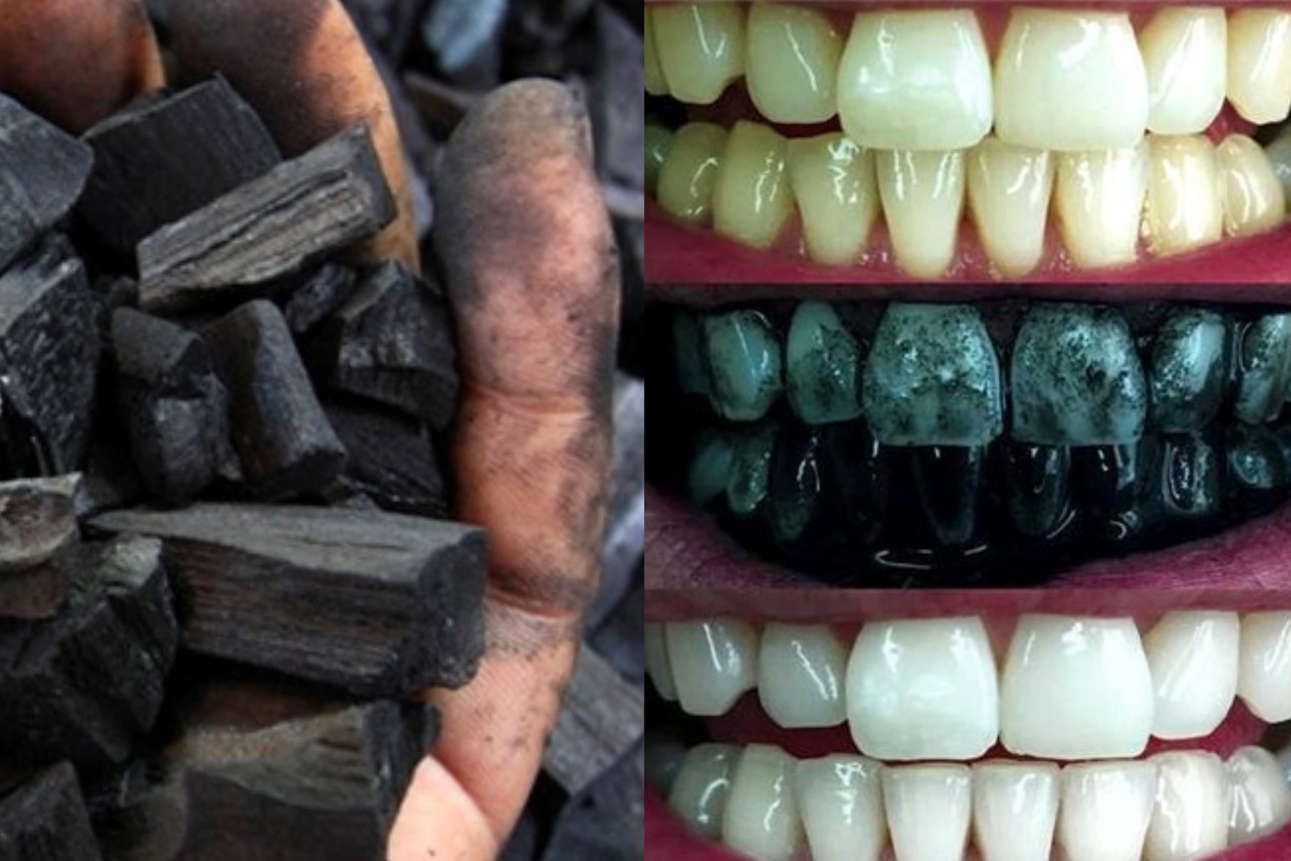 කහ ගැහැනු දත් සුදු කරගන්න මෙන්න ක්රමේ – අඟුරු ගැන ඔබ නොදන්නා ඉතා වටිනා කරුණු රැසක් මෙන්න