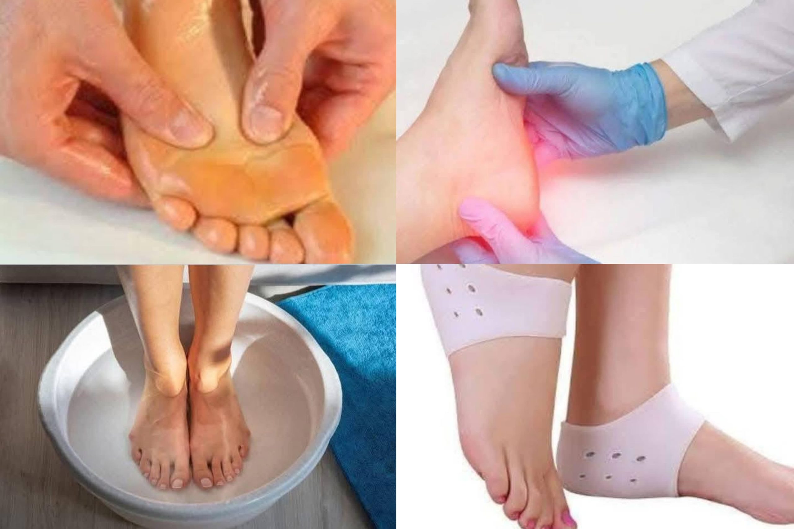 නිතරම ඇති වෙන විලුඹේ වේදනාව සමනය කරන්න නිවසේදිම කලහැකි අත්දුටු බෙහෙත් මෙන්න