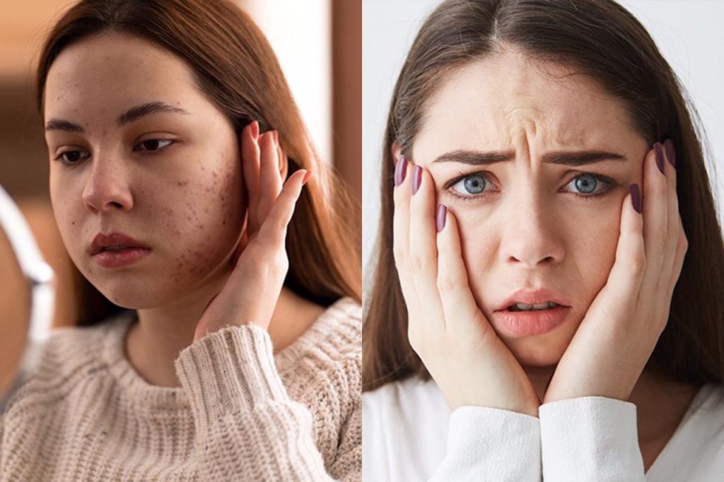 ඔබත් මේ වැරදි කරන්න පුරුදුවෙලානම් ඔබේ සුන්දරත්වය ඉක්මණින් නැති වෙලා යන්න පුලුවන් ! ලස්සන ගැන හිතන ගැහැනු ළමයි මේ කරුණු ගැනත් අනිවාර්යයෙන්ම දැනගන්න