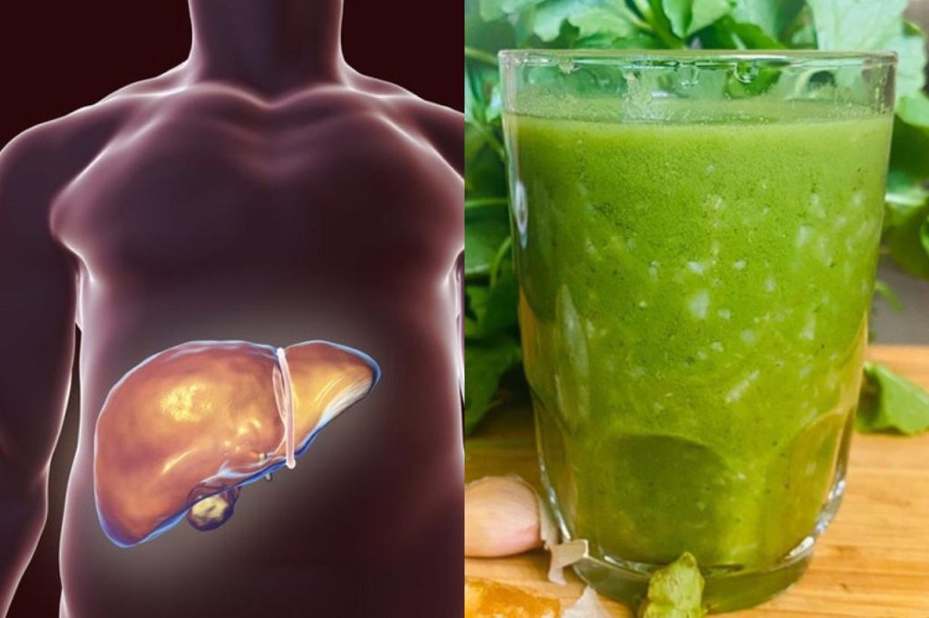 අක්මාවේ මේදය තැම්පත්වීම වලකන ඔබේ අක්මාව සුවපත් කරන විශ්මිත හෙළ ඔසු ගැන දැනගන්න