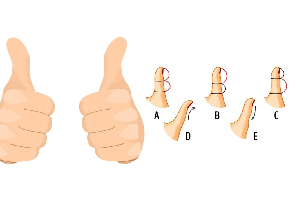 බලන්නකෝ ඔබත් මේ වගේද කියලා ? මහපට ඇගිල්ලේ හැඩය අනුව ඔබ ගැන කියවෙන සත්ය අනවැකි මෙන්න