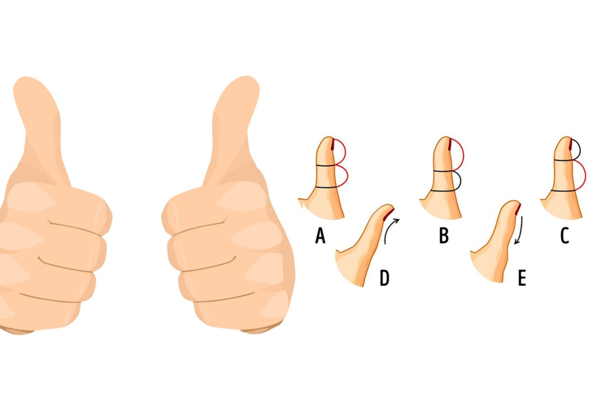 බලන්නකෝ ඔබත් මේ වගේද කියලා ? මහපට ඇගිල්ලේ හැඩය අනුව ඔබ ගැන කියවෙන සත්ය අනවැකි මෙන්න