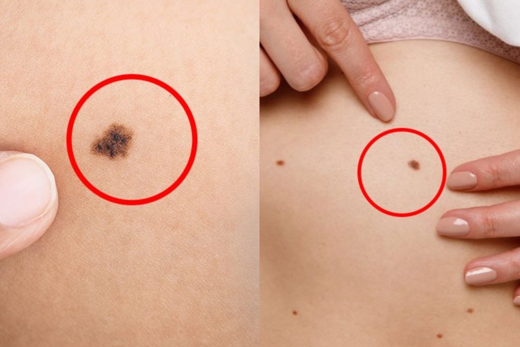 දන්නවද ඔබේ උපන් ලපයෙන් ඔබ ගැන බොහෝ දේ කියවෙනවා කියලා… ඉපැරැණි ග්රන්ථයකින් උපුටාගත් උපන් ලප ගැන කියවෙන අනාවැකි රැසක් මෙන්න