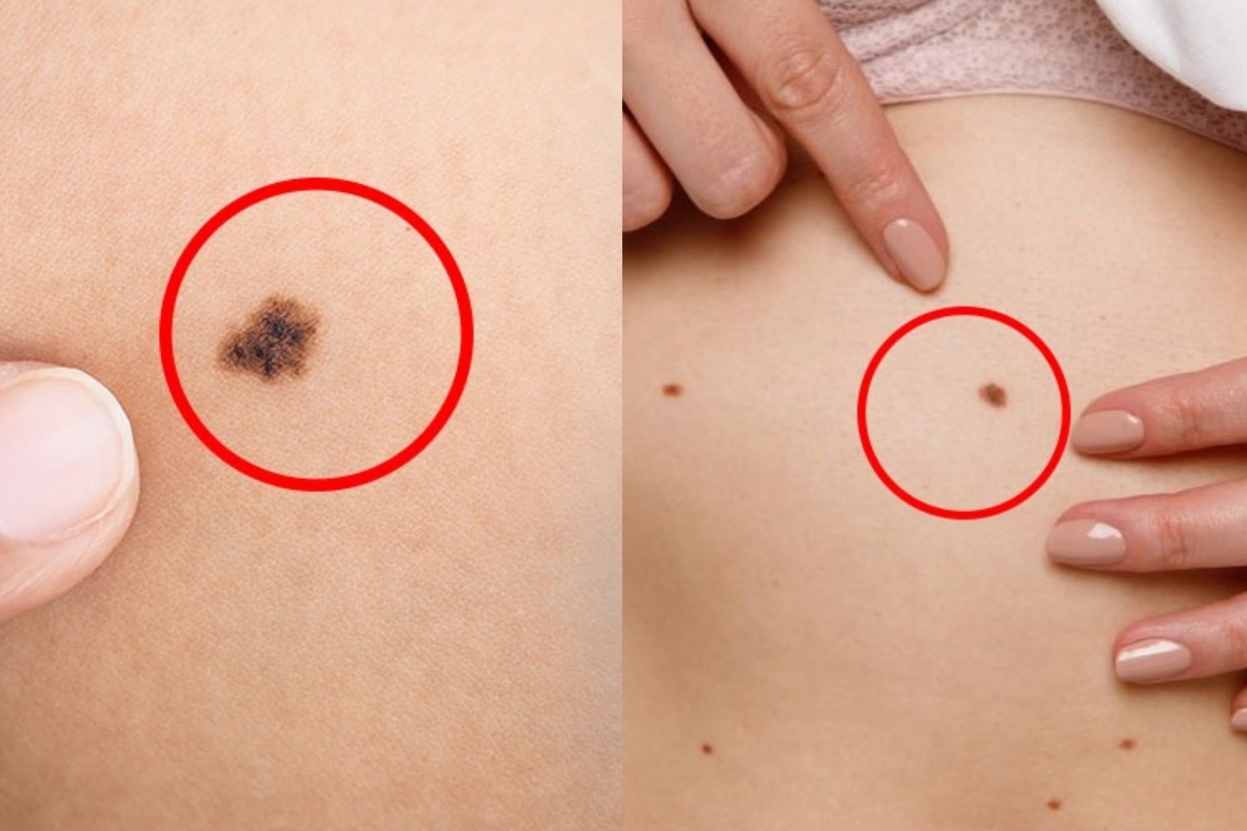 දන්නවද ඔබේ උපන් ලපයෙන් ඔබ ගැන බොහෝ දේ කියවෙනවා කියලා… ඉපැරැණි ග්රන්ථයකින් උපුටාගත් උපන් ලප ගැන කියවෙන අනාවැකි රැසක් මෙන්න