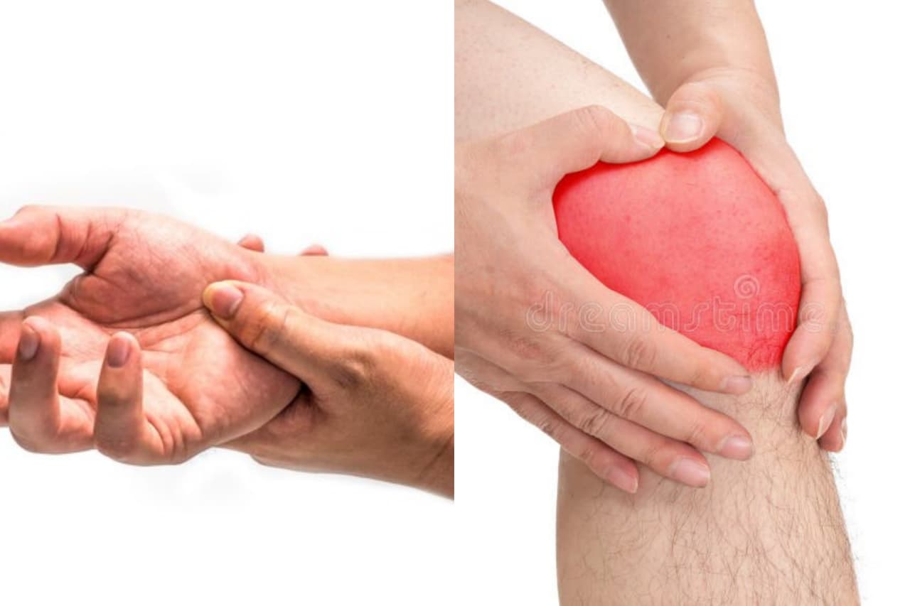 ආතරයිටිස් නොහොත් හන්දිපත් රුදාවෙන් මිදෙන්නේ මෙහෙමයි…