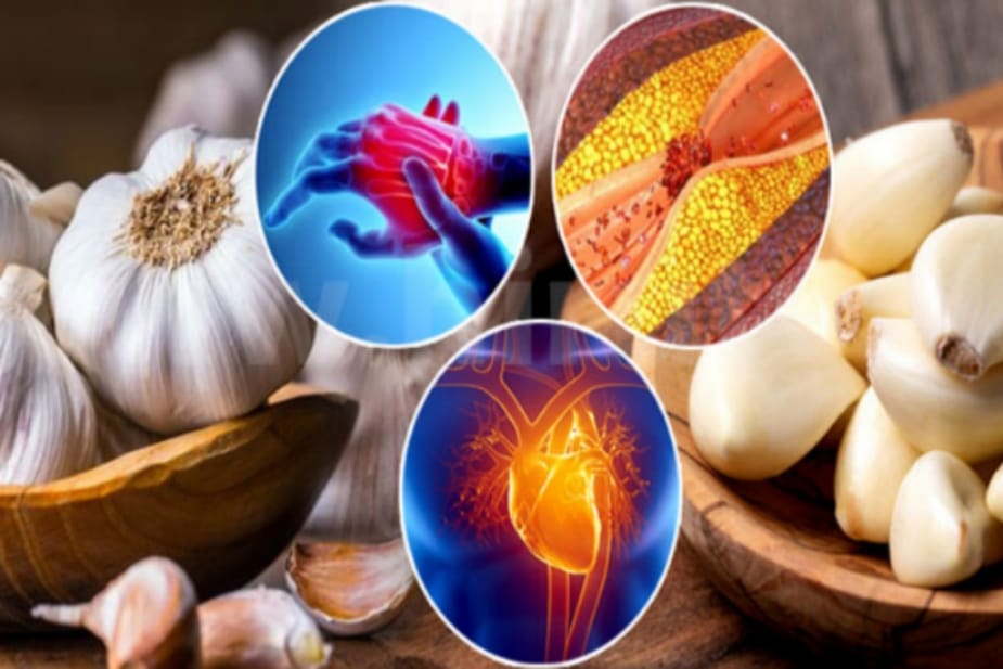 ඔයාටත් මේ ලෙඩ තියෙයිද ? එහෙනම් සුදු ළූණු කන්න හිතන්නවත් එපා !