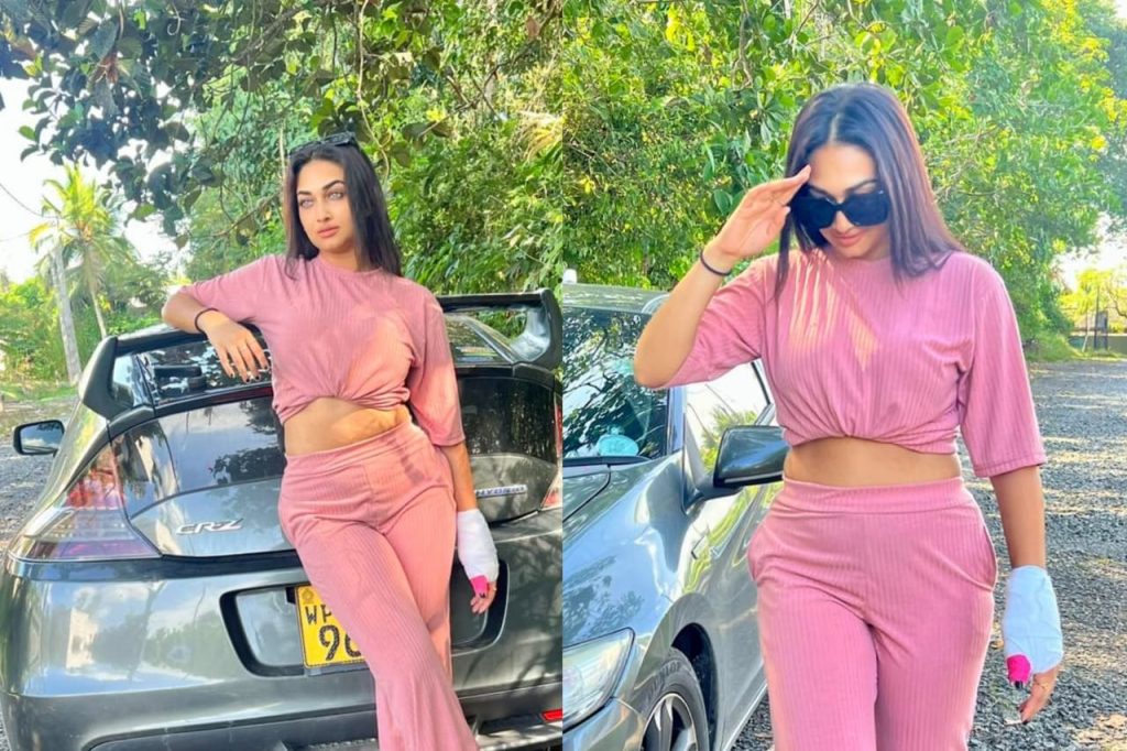 රටක් වශී කල ආදරණීය සුරූපි ඇය, දේශානි නෙහාරා… අනේ.. එයාගේ අතට මේ මොකද්ද වෙලා තියෙන්නේ ?