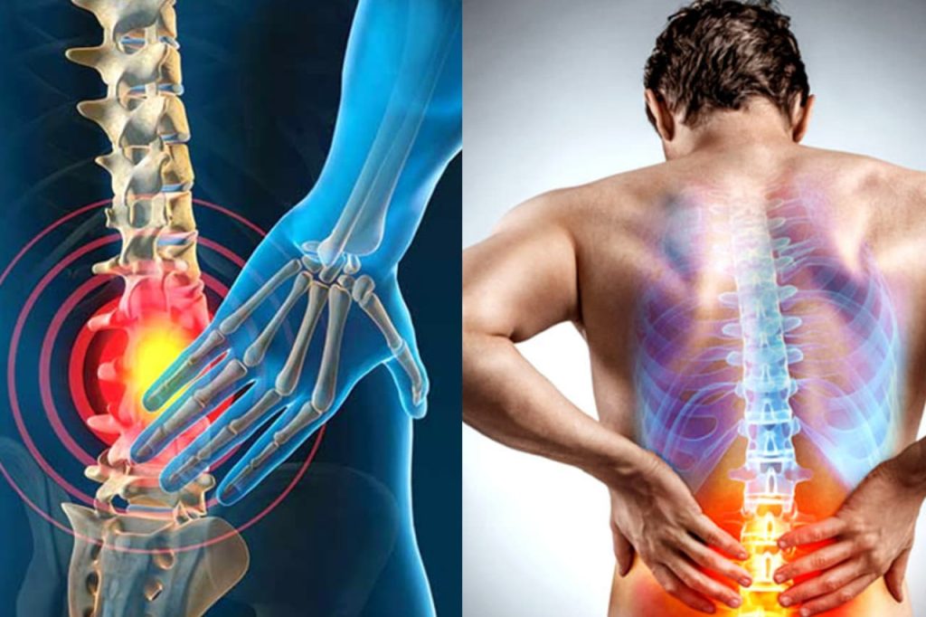 ඔයත් කොන්දේ කැක්කුම නිසා වද විදින කෙනෙක්ද ? මේ අත් බෙහෙත කරලා බලන්න. කොන්දේ කැක්කුම කොහෙන් ගියාද නෑ