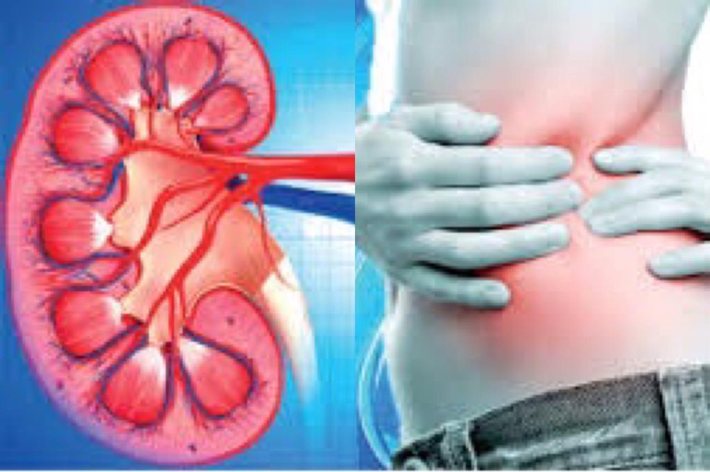 ඔබට වකුගඩු රෝගයක් තිබේදැයි මුලික අවස්ථාවේම දැන ගන්නේ මෙහෙමයි…