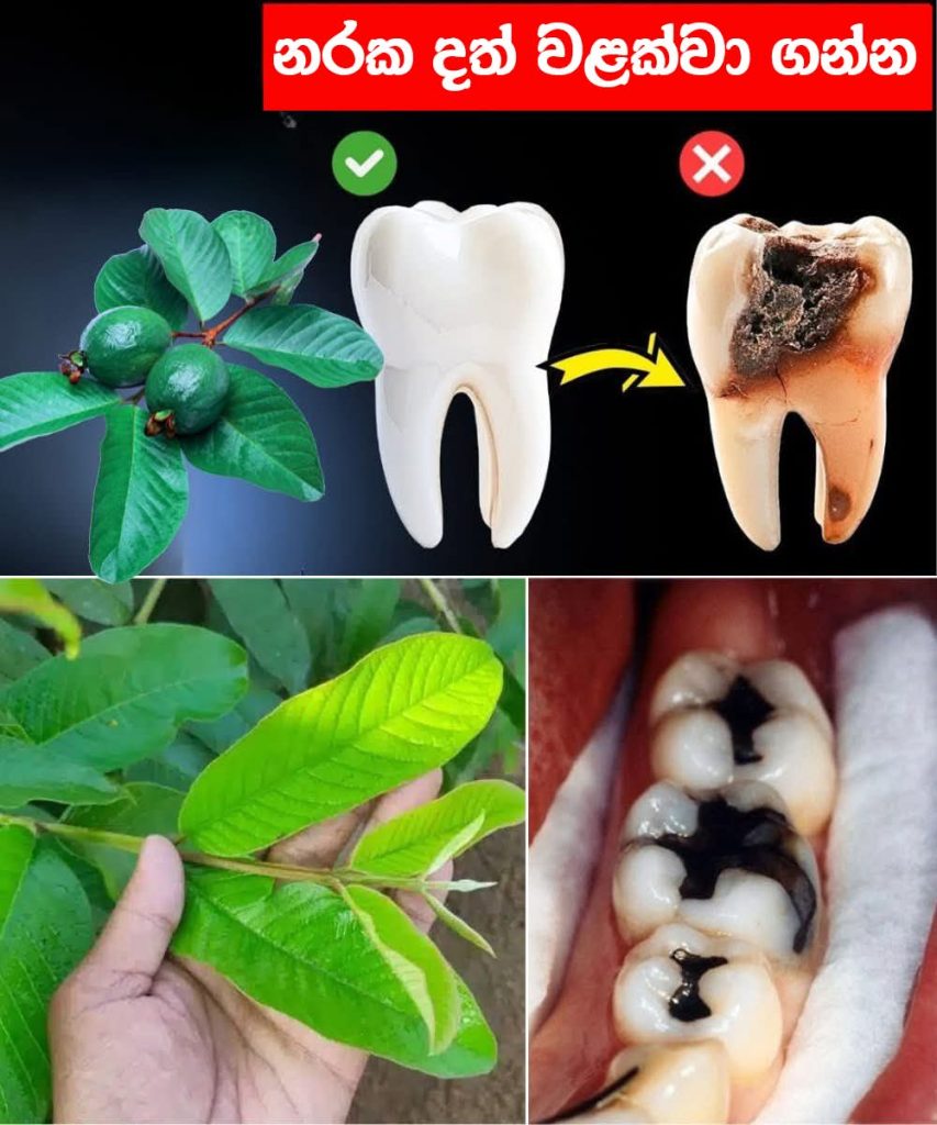 දත් නරක් වෙන එක නතර කරන්න පේර කොළ වලින් ගෙදරදීම කරන්න පුලුවන් විශ්මිත ප්‍රතිකාර කිහිපයක් මෙන්න