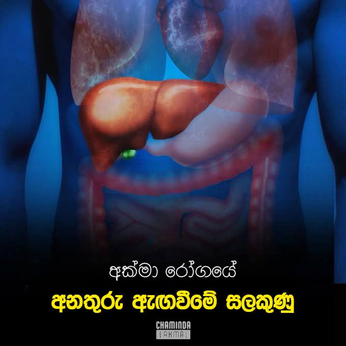 ඔයාගෙත් අක්මාව ලෙඩ වෙලා කියලා වේලාසනින්ම දැනගන්න තියෙන ලැබෙන ලක්ෂණ මෙන්න… මේ දේවල් ඔයාටත් තියෙයි නම් අදම ප්‍රතිකාර ගන්න