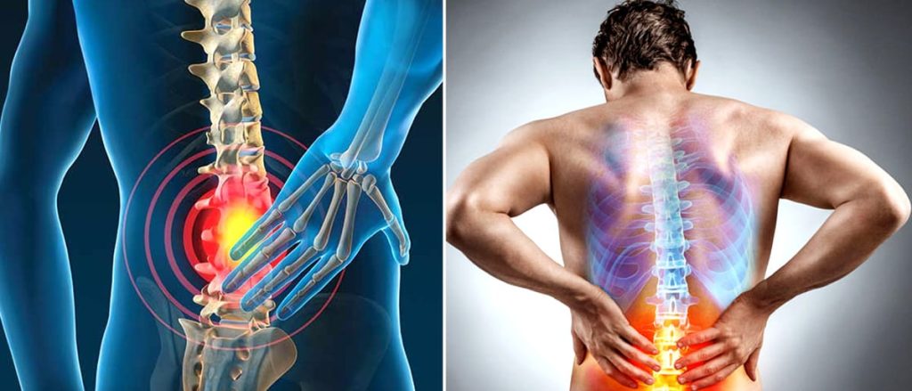 කොන්දේ කැක්කුම නොසලකා හරින්න එපා.. එහෙම කියන්නේ මෙන්න මේ හින්දා…