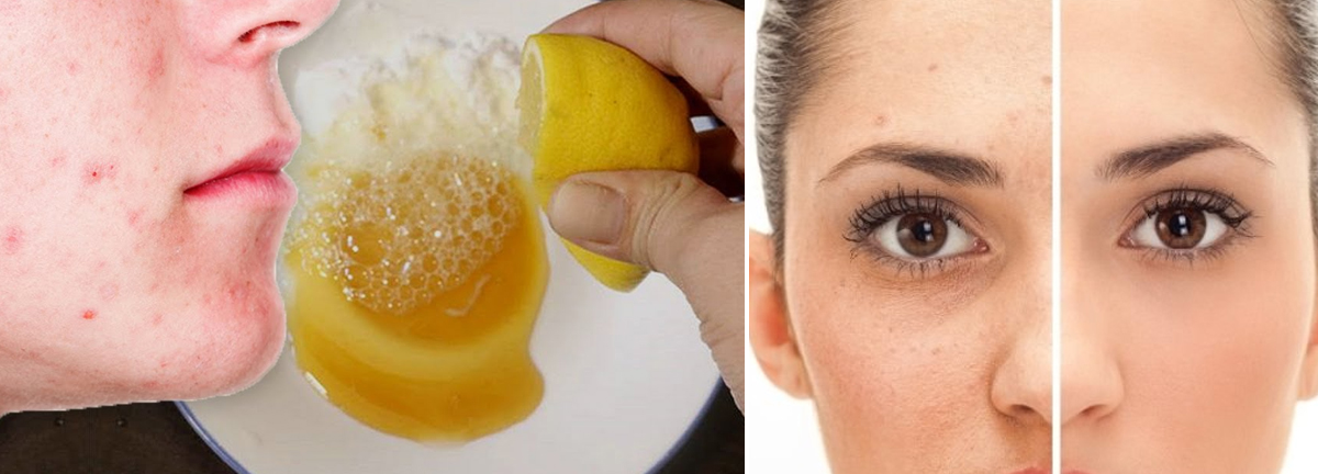 ඔයත් කුරුලෑ කඩා ඉවත් කරන කෙනෙක්ද? එහෙනම් මේ කරුණු අනිවාර්යෙන් දැනගන්න…