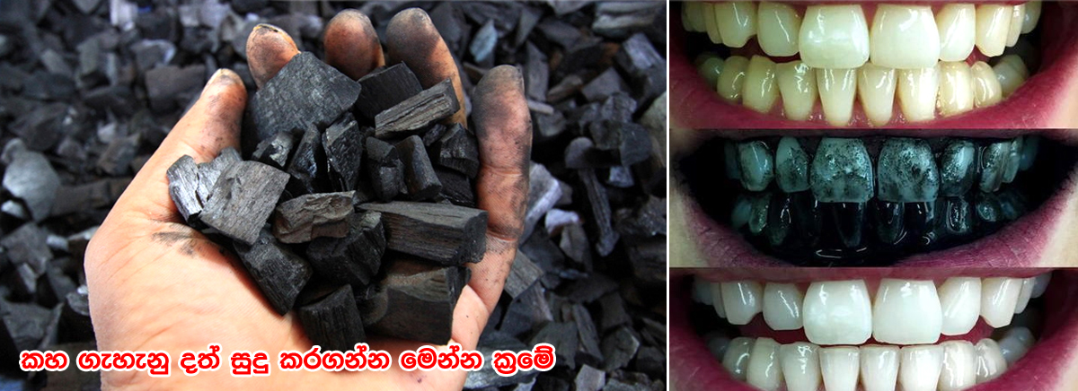 කහ ගැහැනු දත් සුදු කරගන්න මෙන්න ක්රමේ – අඟුරු ගැන ඔබ නොදන්නා ඉතා වටිනා කරුණු රැසක්
