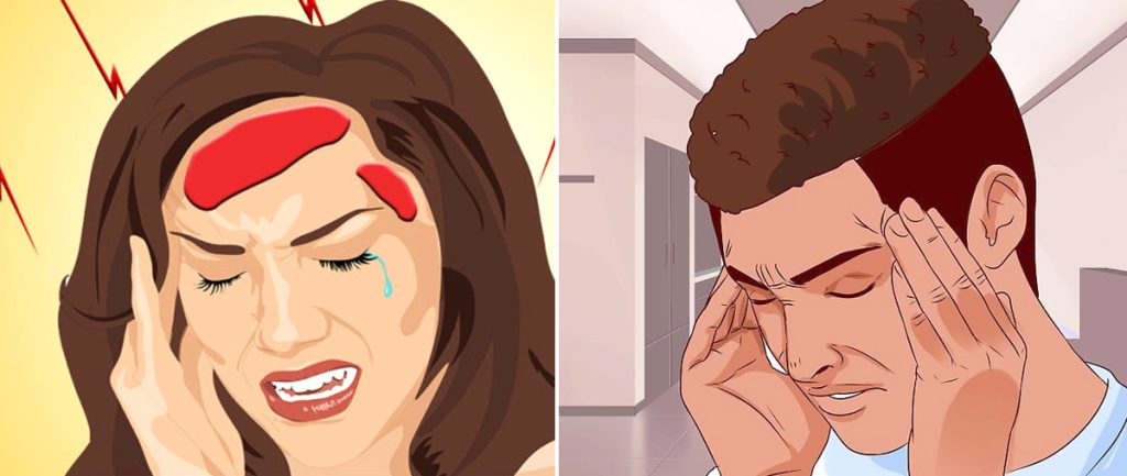 මිග්රේන් – ඉරුවාරදය නැත්තටම නැති කරගන්න මේ කෑම වර්ග ආහාරයට ගන්න