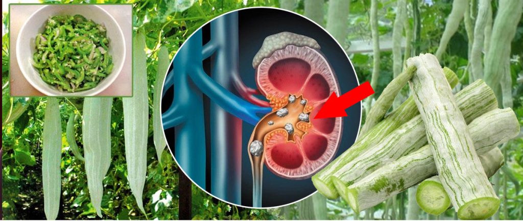 කවුරුත් කන්න අකමැති පතෝල වල ඇති ස්වභාවිකවම වකුගඩුවල ගල් ඉවත් කිරීමේ විශ්මිත ගුණය ගැන ඇහුවොත් ඔබත් පුදුම වෙයි