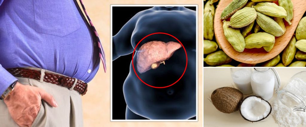 අක්මාවේ මේදය තැන්පත්වීම වළකන ඔබ හිතන්නෙවත් නැති විශ්මිත දිව ඔසු මෙන්න