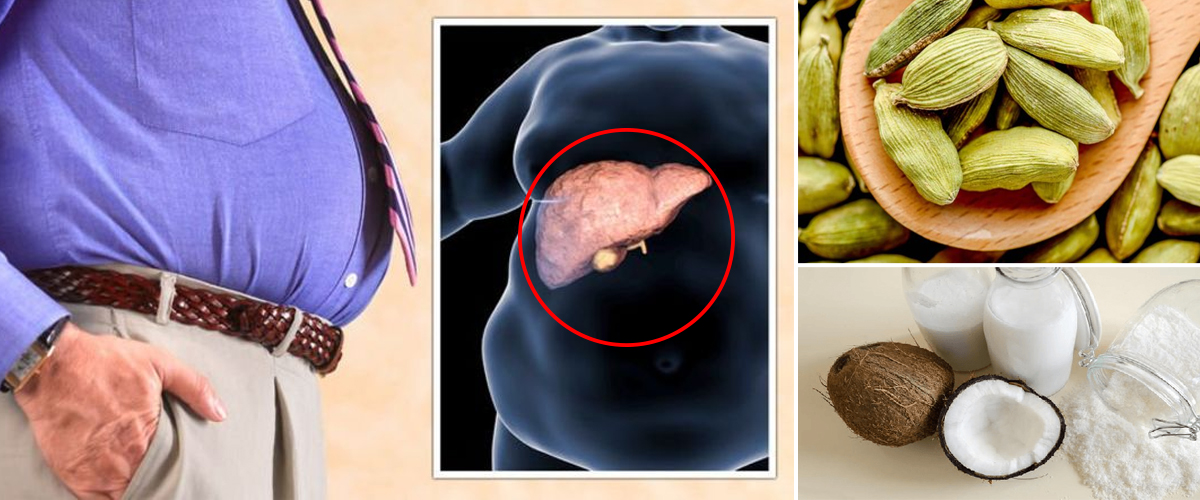 අක්මාවේ මේදය තැන්පත්වීම වළකන ඔබ හිතන්නෙවත් නැති විශ්මිත දිව ඔසු මෙන්න