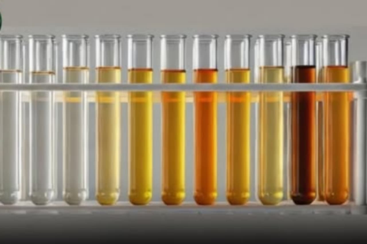 කවදා හෝ ඔබේ මුත්රා වර්ණ දෙස බලා එයින් කියවන මේ දේ ගැන දැනුවත් වී තිබේද ? මුත්රා වර්ණයේ තේරුම මෙන්න