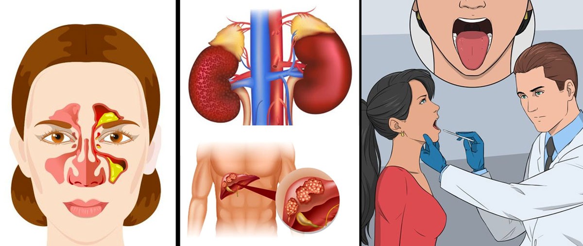ඔබේ මුඛයෙන් හමන හුස්මෙහි ගන්ධය මඟින් හෙළි කළ හැකි සෞඛ්ය තත්වයන්
