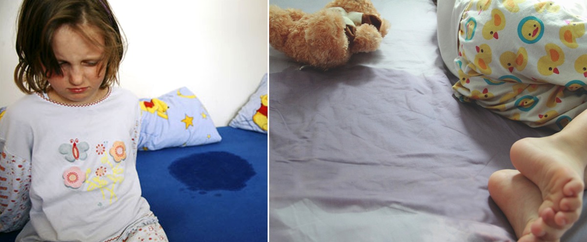 ඔබේ දරුවාත් නින්දෙන් මුත්රා කරනවද? දරුවන් නින්දෙන් මුත්රා කිරීම ස්වභාවික පිළියම් වලින් වලකාගත හැකි ක්රම රැසක් මෙන්න