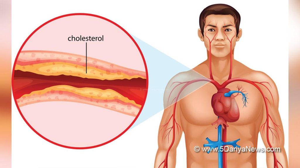 කොලෙස්ටරෝල් හැදිලද කියලා දැනගන්නේ මෙහෙමයි…