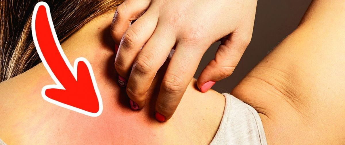 90% ම නොසලකා හරින පි ළි කා රෝගයේ රෝග ලක්ෂණ කල් තියාම හදුනා ගමු…