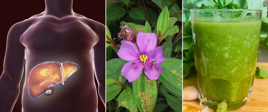 අක්මාවේ මේදය තැන්පත් වීම නිට්ටාවටම නැති කරන ඔබ මීට පෙර නොදත් හෙළ ඔසුවක් මෙන්න.