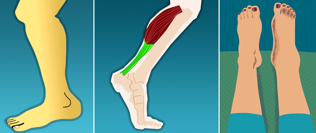 පාදවල සිදුවන වෙනස්කම් වලින් හෙළිවෙන බරපතල රෝග 9ක් ගැන කියවෙන ඔබ නොදත් කරුණු මෙන්න.