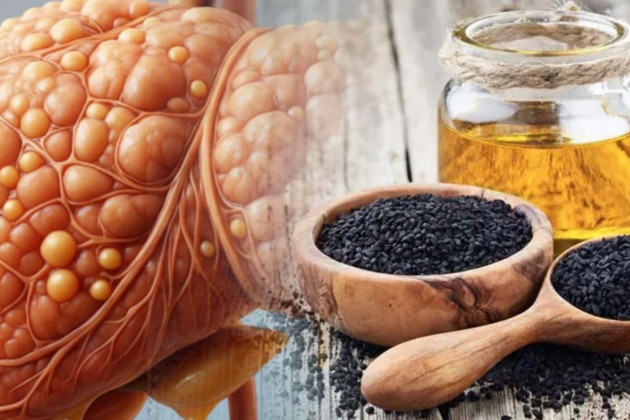 නවීන සොයාගැනීමක්.කළු දුරු ඇට ග්රෑම් 1කට අක්මාවේ මේදය දහනය කරන්න පුලුවන්.දැන් ඉතින් අක්මාවෙ තෙල් තැන්පත් වීම ගැන වද වෙන්න දෙයක් නෑ.