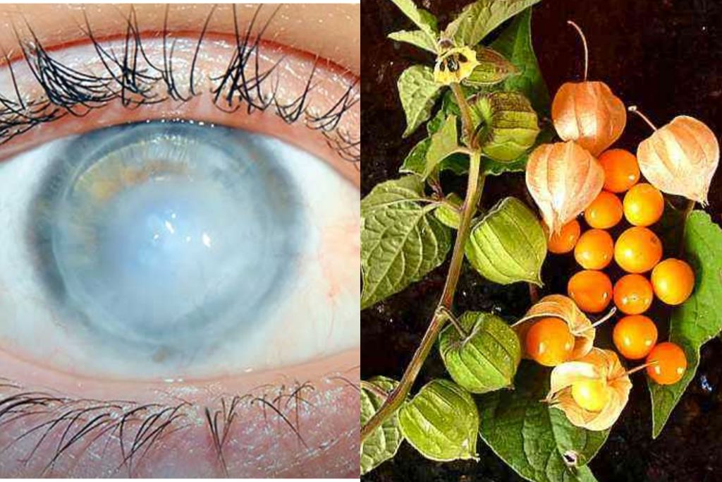 ඇසේ සුද ඉවත් කරන විශ්මිත දිව ඔසුවක් ගැන ඔබ නොදත් තොරතුරු මෙන්න… වල් පැළෑටියක් කියලා විසි කරන්න එපා…